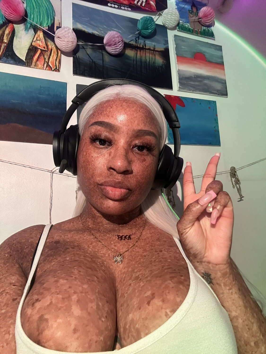 Freckles #0lD7RBry