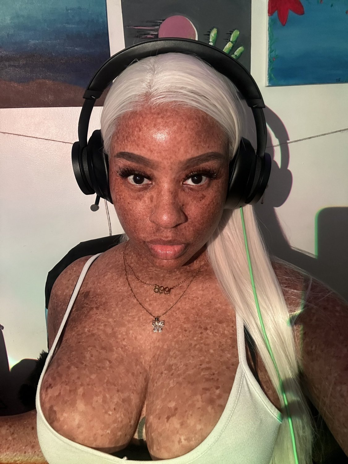 Freckles #5ZsMOCVi