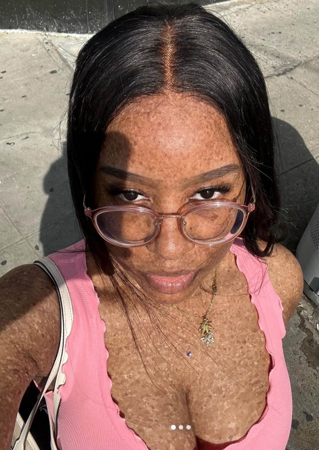 Freckles #RAwlNznX
